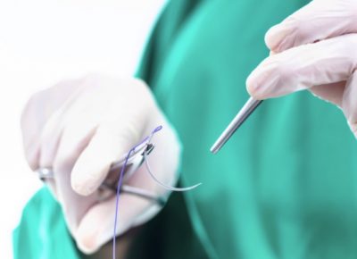 Chỉ sinh học là gì? Ứng dụng các loại chỉ sinh học