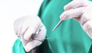 Chỉ sinh học là gì? Ứng dụng các loại chỉ sinh học